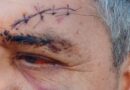 El comisionado municipal de El Zanjón deja su cargo tras la golpiza y posible falsa denuncia que derivó en la detención de una persona